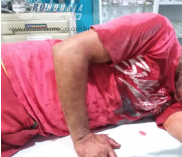 GOV. JORGE TEIXEIRA- SUICÍDIO- Homem tenta tirar a própria vida com disparo de espingarda embaixo do queixo em Governador Jorge Teixeira