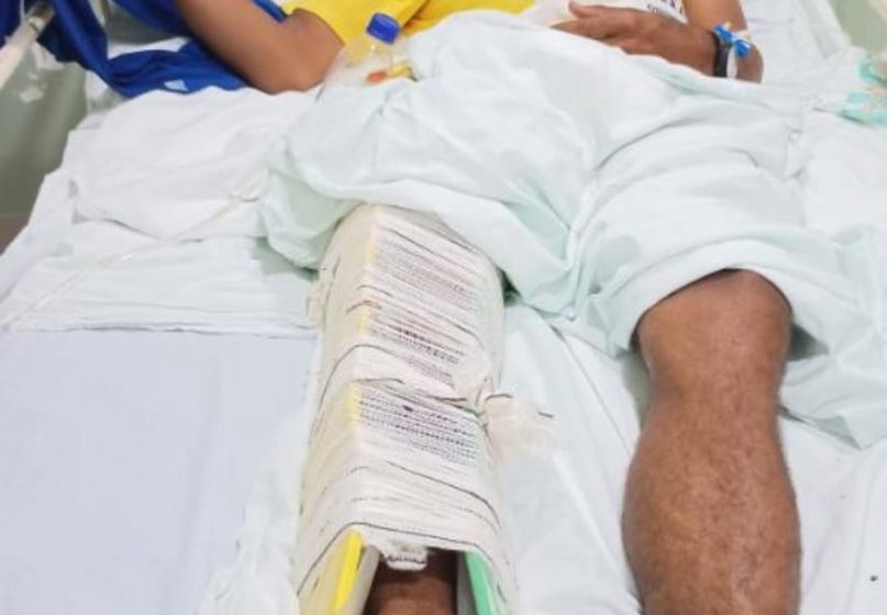  Jovem de Jaru Resgatado após três dias em Ribanceira à Beira da BR-364 passará por Cirurgia em Ji-Paraná