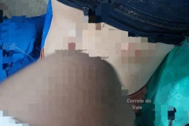  Mulher é esfaqueada em São Miguel; cinco mulheres são acusadas pelo crime